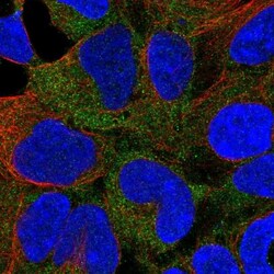 CaM Kinase I Antibody, Novus Biologicals 0.1mL; Unlabeled:Antibodies, Polyclonal